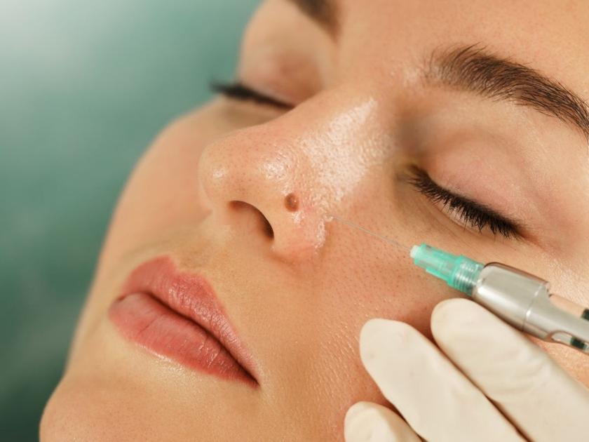 acne-treatment-near-pragathinagar-hyderabad